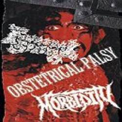 Obstetrical Palsy : Bloody Deeds - Natural Selection - Humans Foolishness Is Limitless